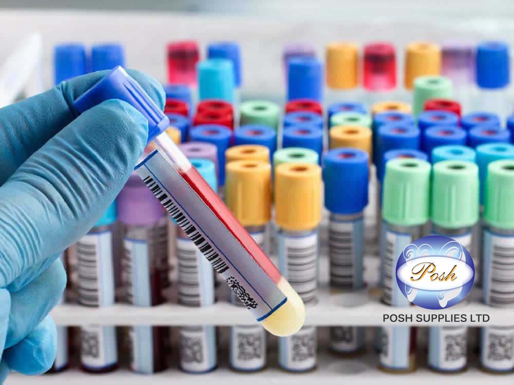 Blood Test Tubes Colors for Sale in Kampala Uganda. Blood Collection Tubes Colors, Lab-Laboratory Consumables Medical Devices and Equipment Uganda, Medical Supply, Medical Equipment, Hospital, Clinic & Medicare Equipment Kampala Uganda. Posh Supplies Limited Uganda, Ugabox