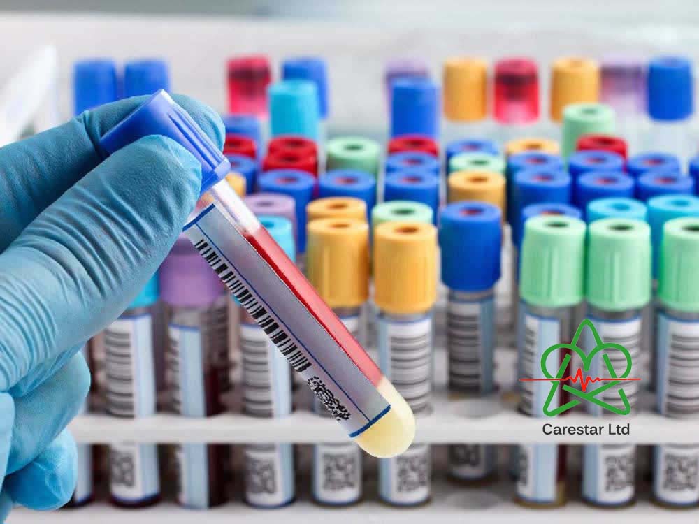 Blood Test Tubes Colors for Sale Kampala Uganda. Blood Collection Tubes Colors, Lab-Laboratory Consumables Medical Devices and Equipment Uganda, Medical Supply, Medical Equipment, Hospital, Clinic & Medicare Equipment Kampala Uganda. CareStar Ltd Uganda, Ugabox