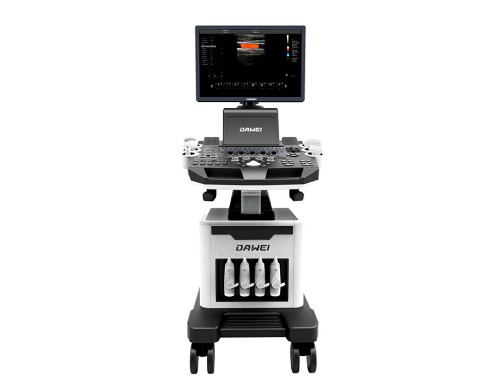 Elastography Machine in Uganda. Buy from Top Medical Supplies & Hospital Equipment Companies, Stores/Shops in Kampala Uganda, Ugabox